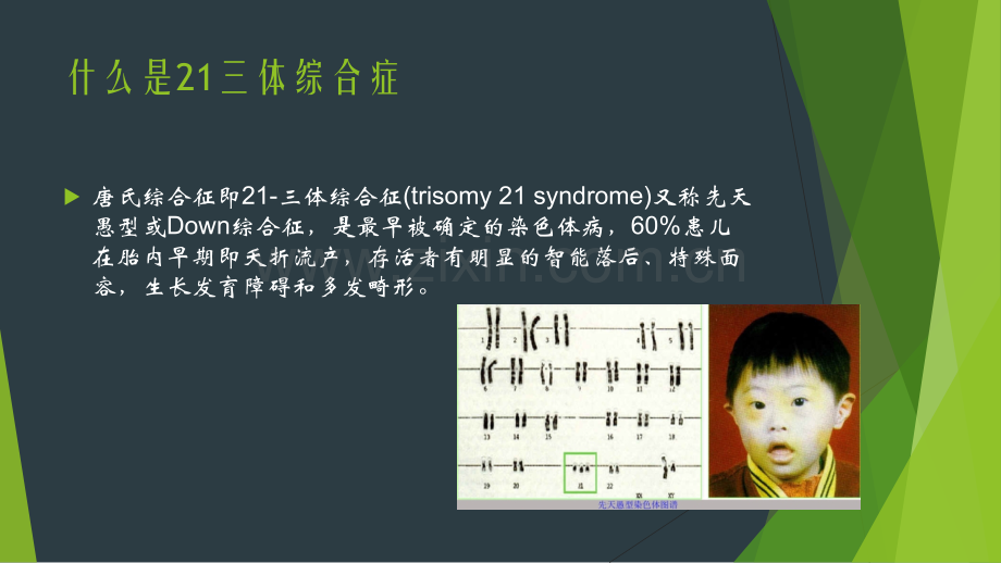 21三体综合症产前诊断方法医学PPT课件.pptx_第2页