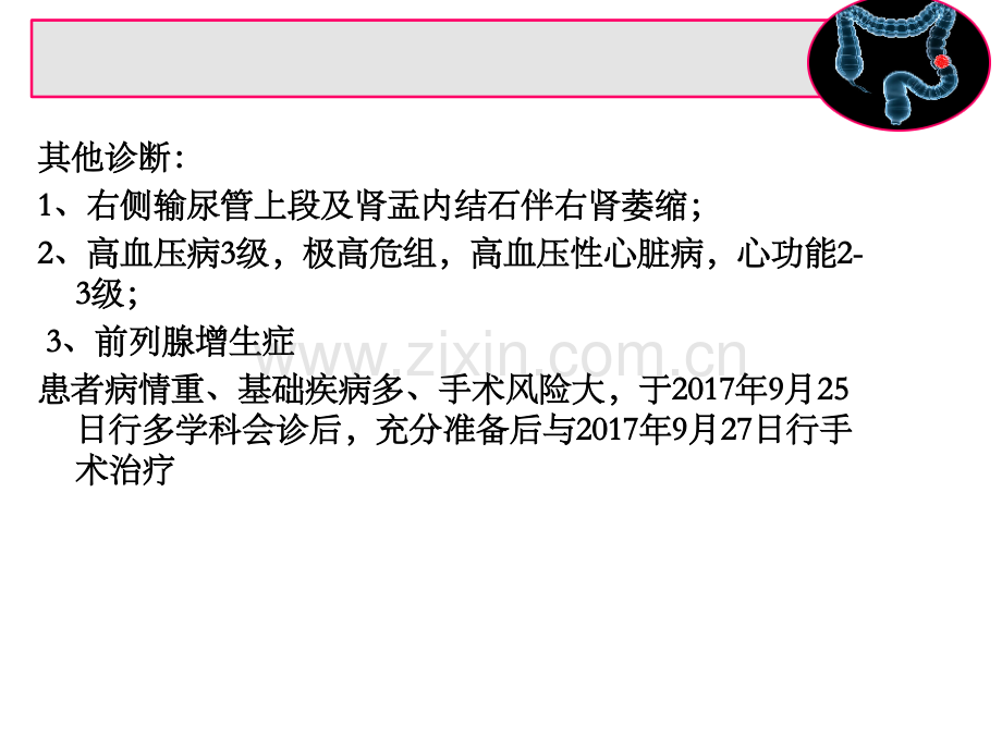 结肠癌的护理查房.pptx_第3页