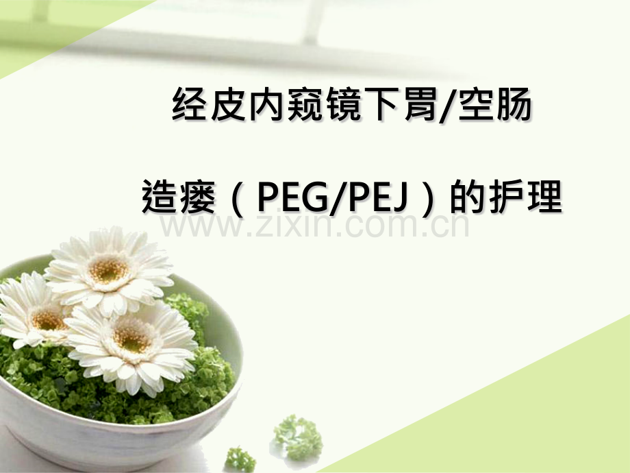 经皮内窥镜下胃空肠造瘘PEGPEJ的护理.pptx_第1页