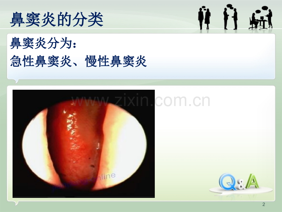 鼻窦炎知识普及修改版.pptx_第2页