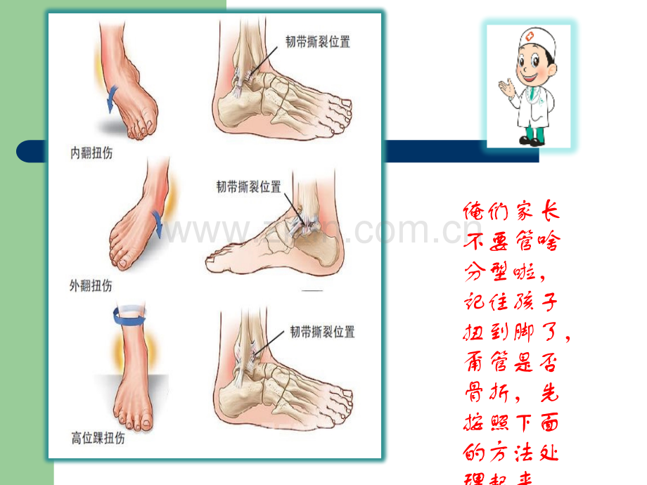 小儿运动损伤ppt课件.pptx_第3页