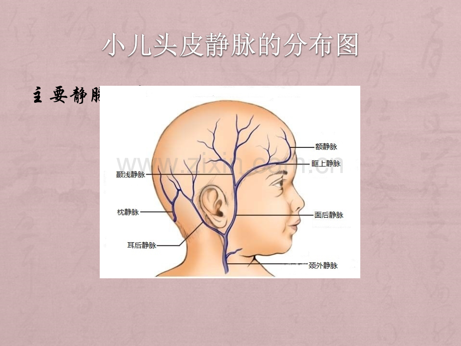 小儿头皮静脉输液.ppt_第3页