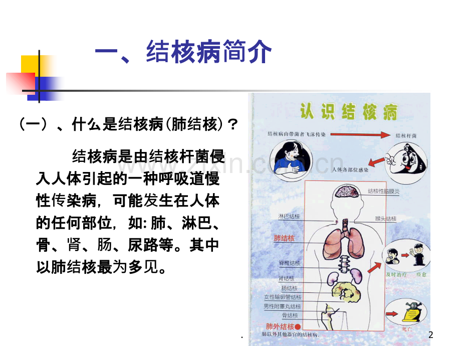 学校结核病(学生)PPT课件.ppt_第2页