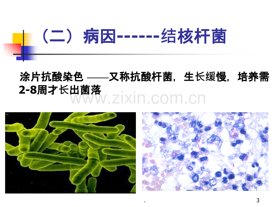 学校结核病(学生)PPT课件.ppt_第3页