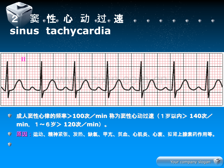 心电图学ppt课件.ppt_第3页