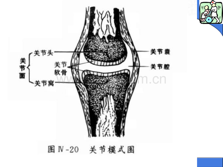 关节脱位病人的护理于红.pptx_第3页