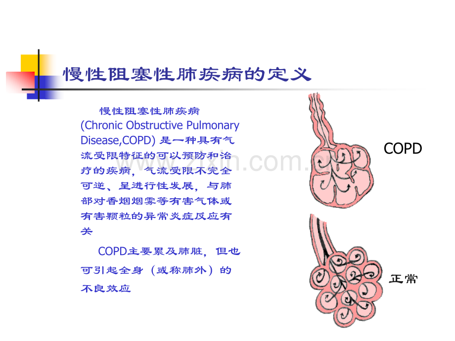 慢性阻塞性肺疾病课件.pptx_第2页