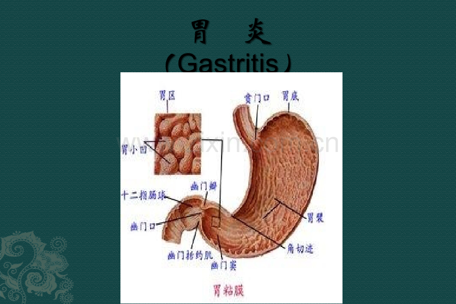 完美医学胃炎.pptx_第1页