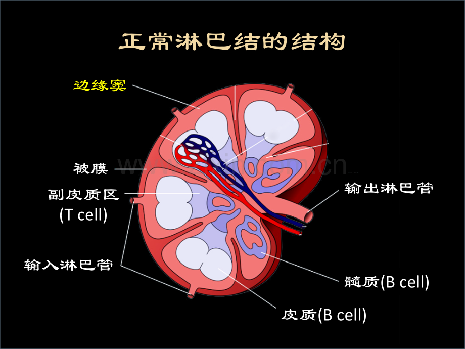 淋巴造血系统淋巴瘤.pptx_第3页