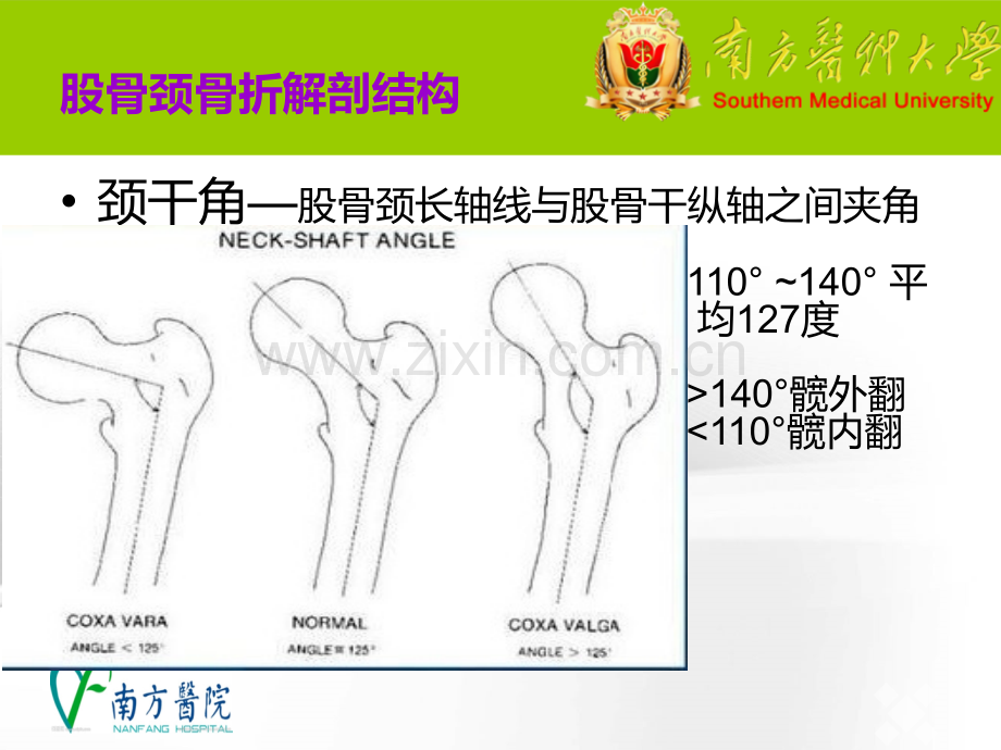 加压空心螺纹钉治疗股骨颈骨折.pptx_第3页