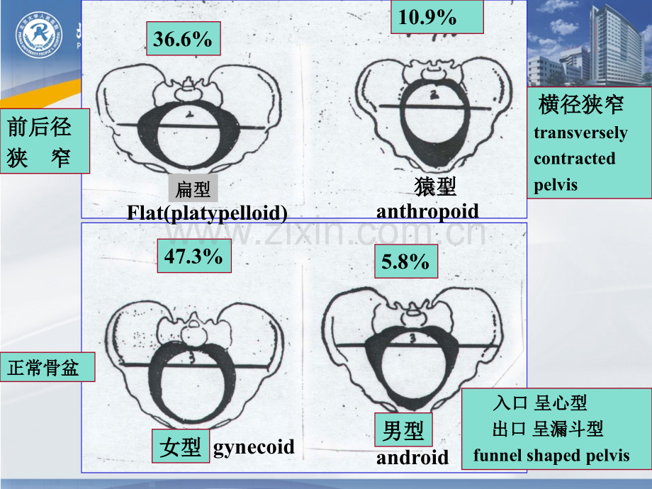 异常产程的识别和处理.pptx_第3页