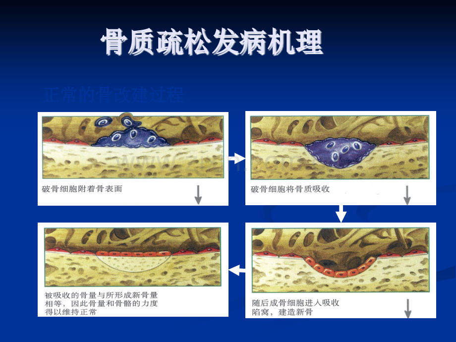 原发性骨质疏松症诊治指南.pptx_第3页