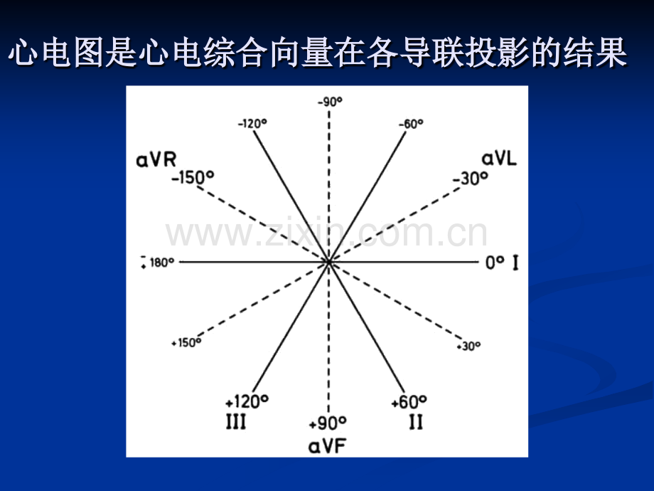 急性心肌梗死心电图及常见心律失常心电图.pptx_第2页