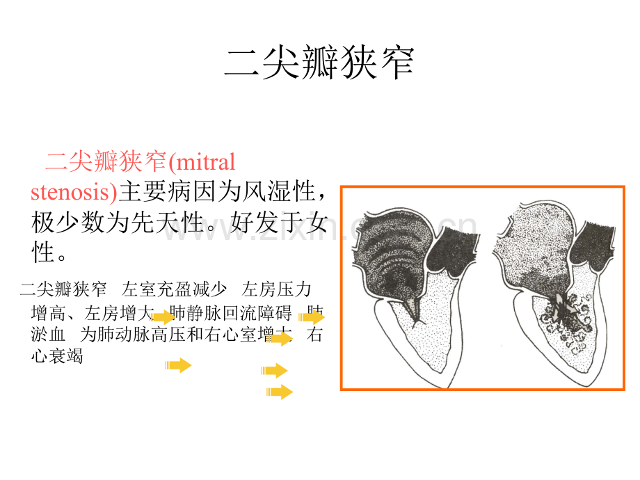 循环系统疾病与症状.pptx_第2页