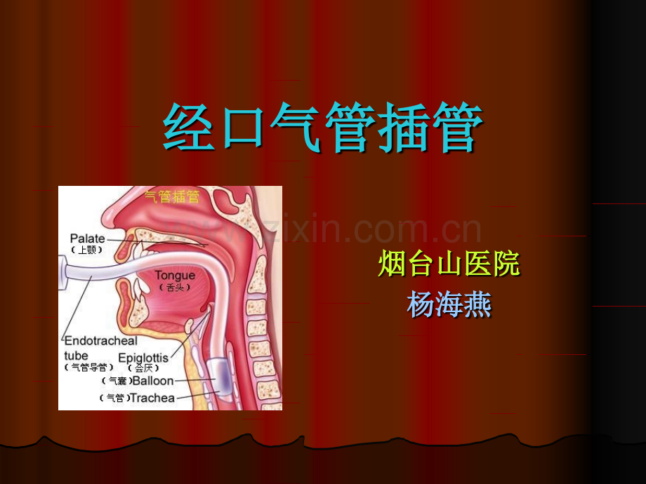 气管插管技术.pptx_第1页