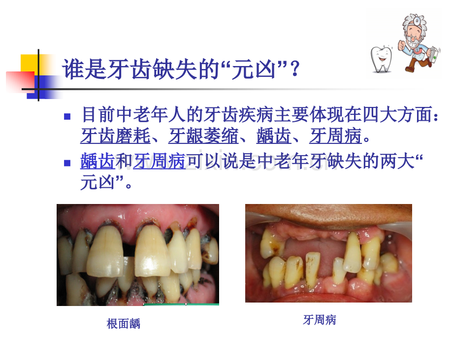 口腔科——中老年科普知识讲座.pptx_第3页