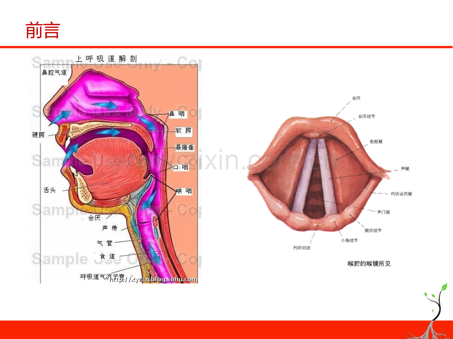 急诊气道管理及气管插管术详解.pptx_第3页