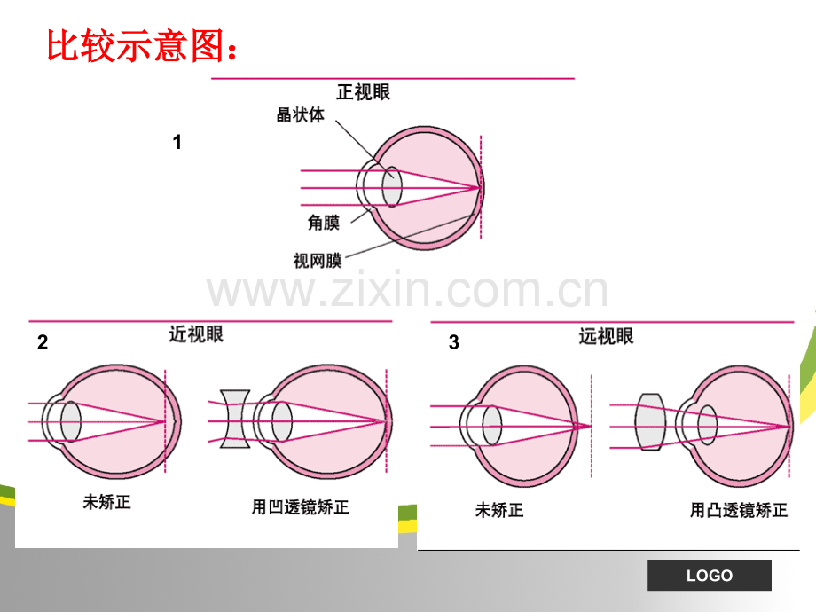 常见病知识1修订稿.pptx_第3页