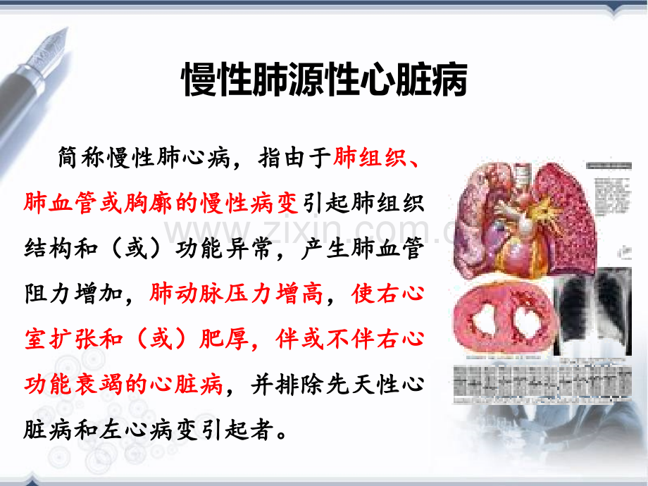 慢性肺源性心脏病3.pptx_第1页