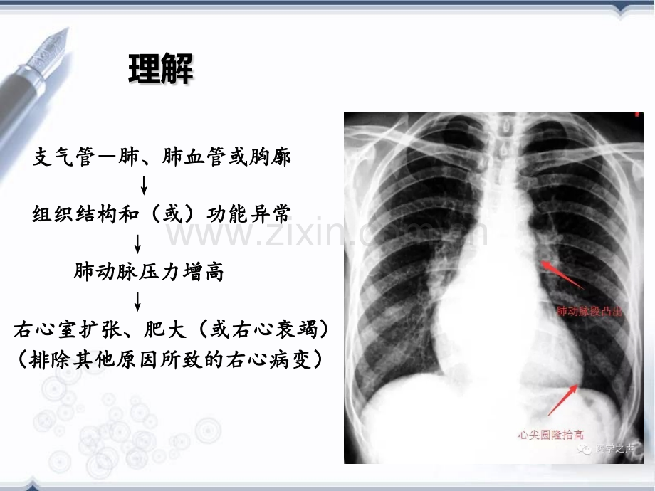 慢性肺源性心脏病3.pptx_第2页