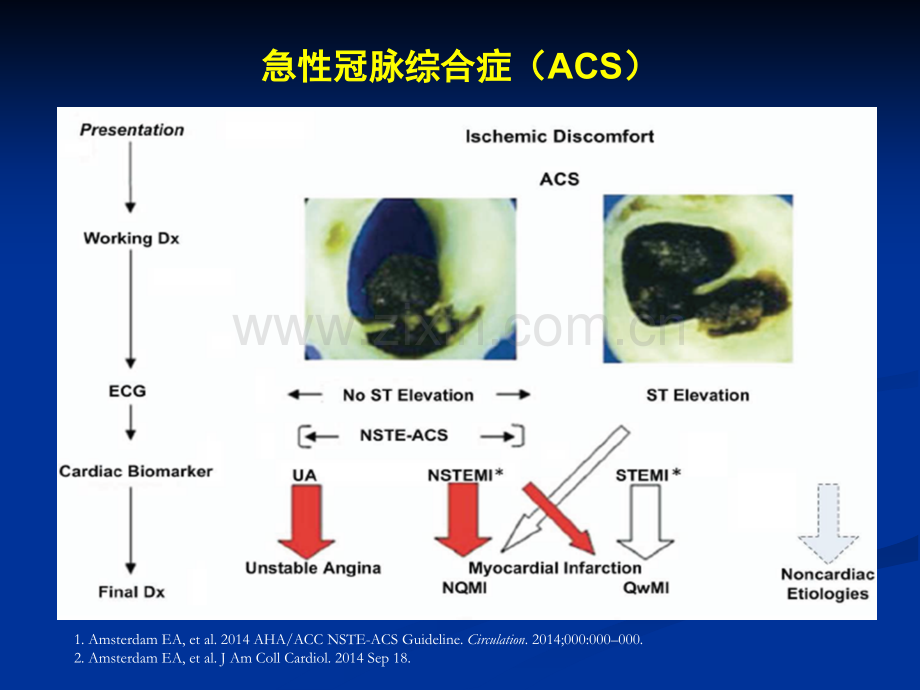 危险分层与规范化诊疗.pptx_第2页