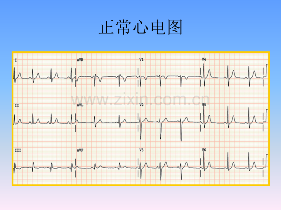 心电图入门教学.pptx_第2页