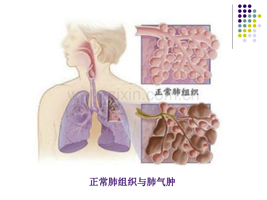 慢性阻塞性肺疾病1文档资料.pptx_第2页