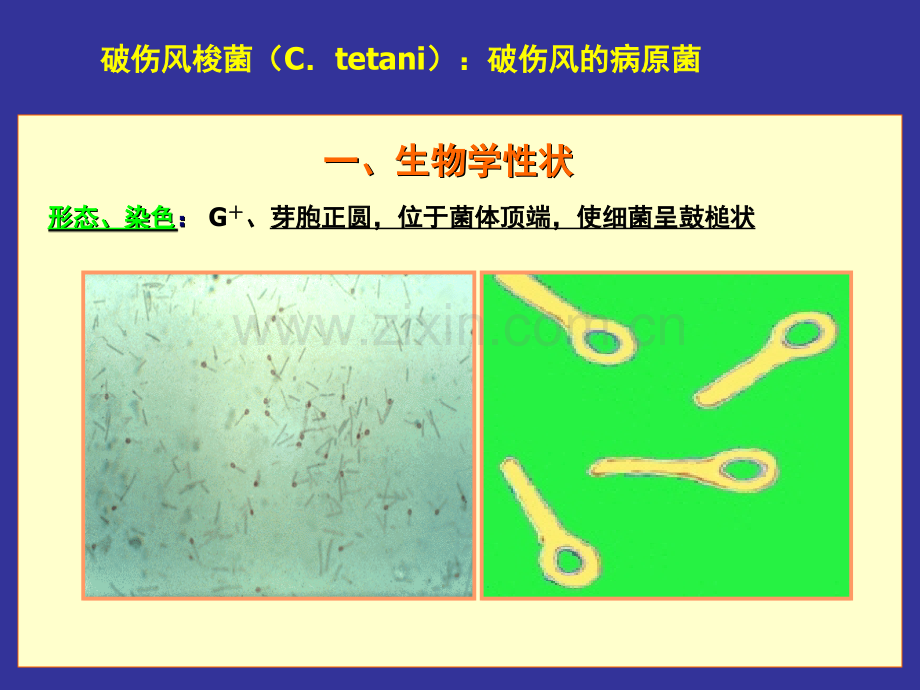 微生物学厌氧性细菌.pptx_第3页