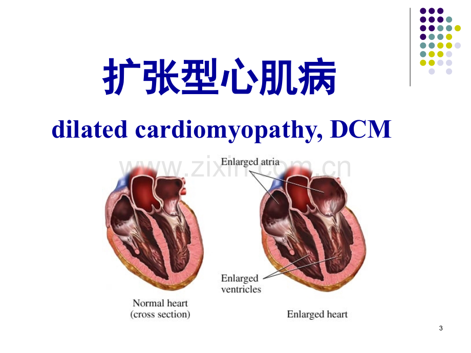 内科学——心肌疾病七年制课件.pptx_第3页