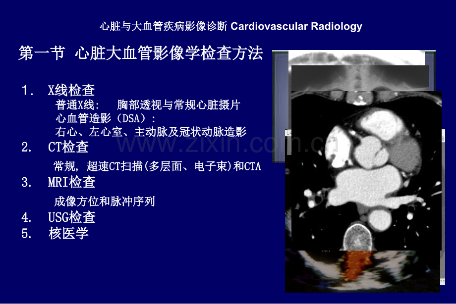影像诊断学心脏和大血管.pptx_第2页