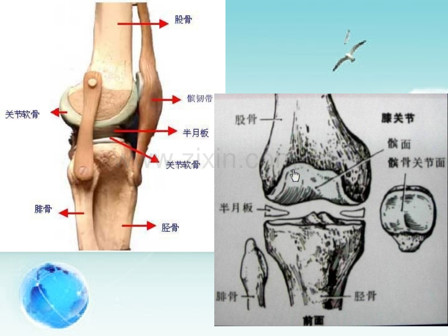 关节镜术后及护理111.pptx_第3页