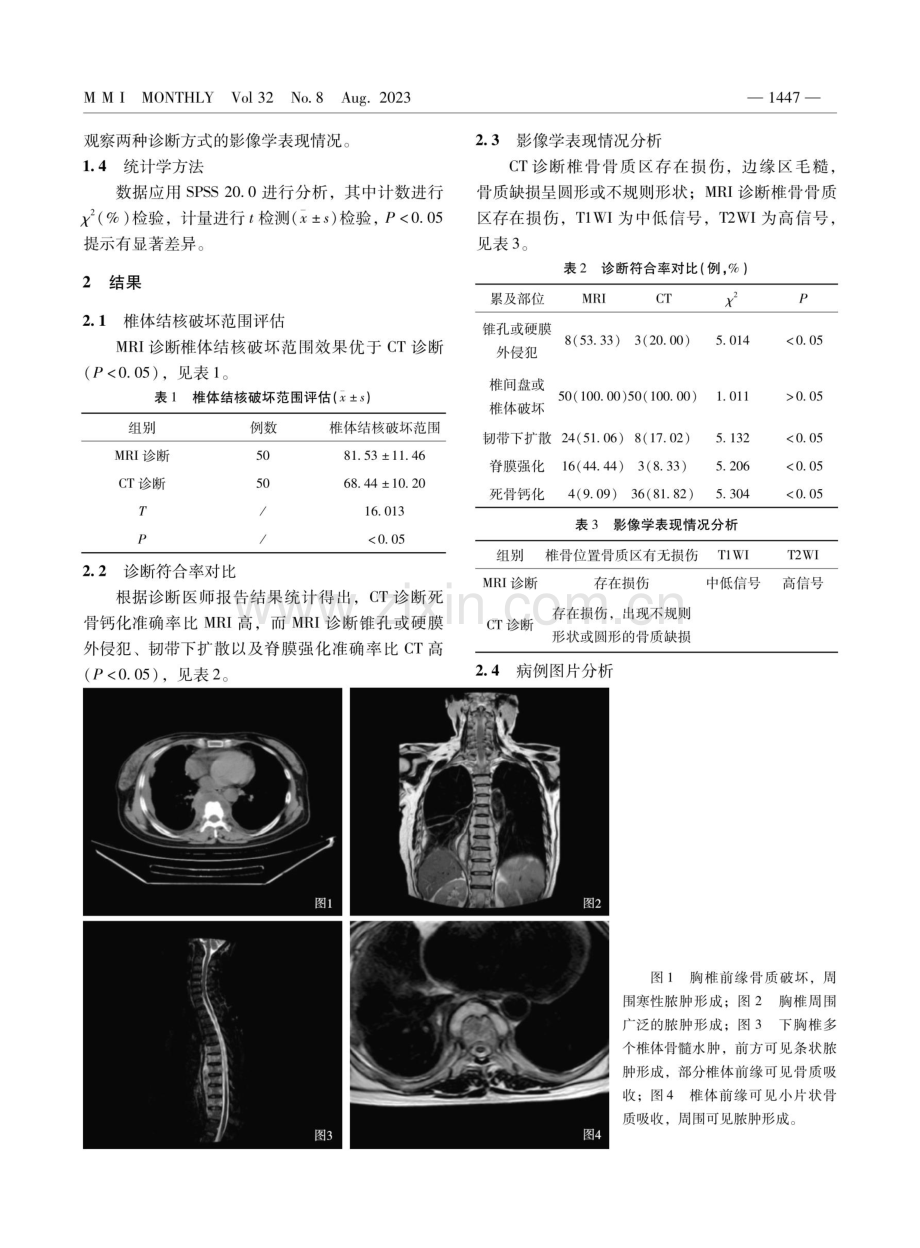 脊柱结核CT与MRI影像诊断临床价值对比研究.pdf_第2页