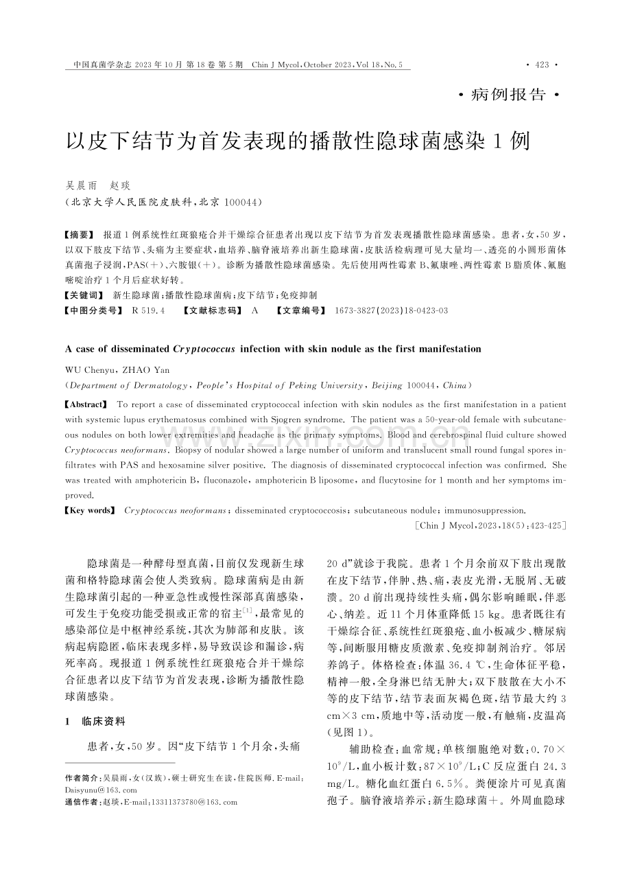 以皮下结节为首发表现的播散性隐球菌感染1例.pdf_第1页