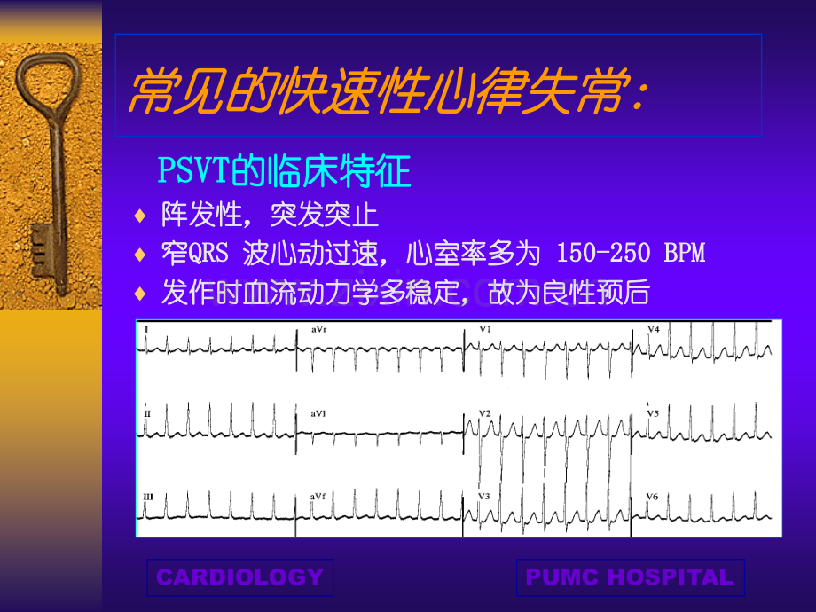 快速性心律失常.pptx_第3页