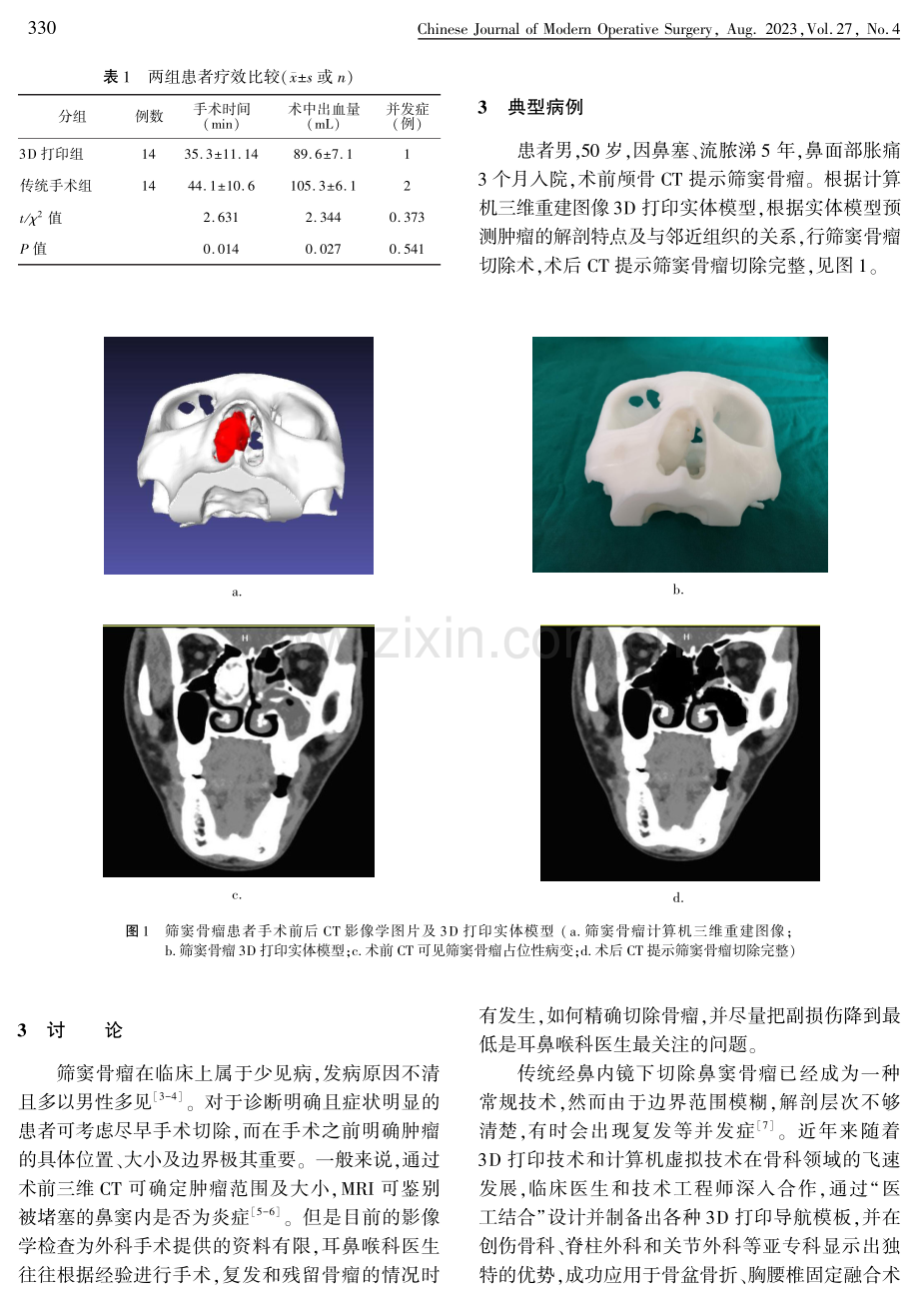 计算机三维重建联合3D打印技术在筛窦骨瘤手术中的临床应用.pdf_第3页