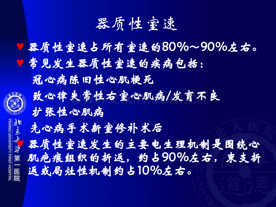 器质性室性心动过速射频消融丁燕生.pptx_第2页