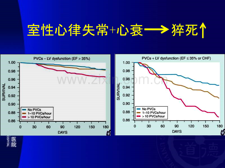 器质性室性心动过速射频消融丁燕生.pptx_第3页