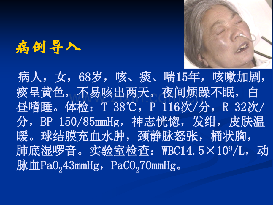 内科学呼吸衰竭1.pptx_第2页