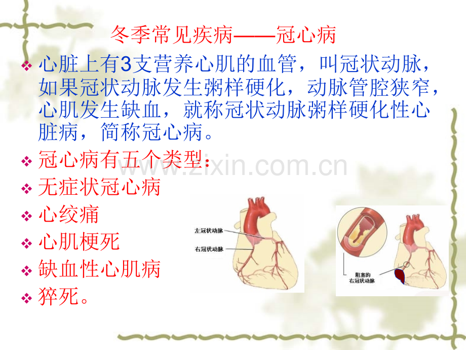 冬季中老年人常见疾病预防及保健.pptx_第3页