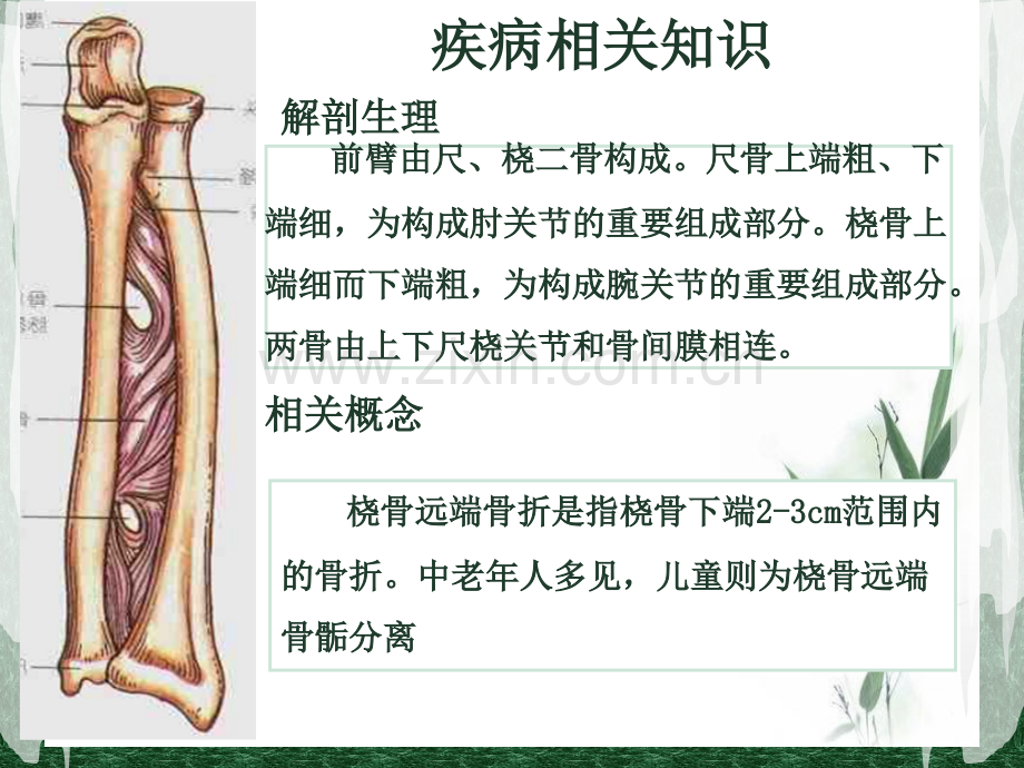 护理查房右尺桡骨骨折康复护理.pptx_第3页