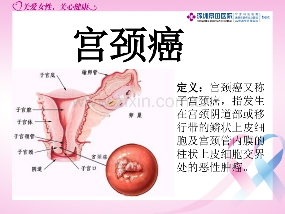 宫颈癌与乳腺癌的防治.pptx_第3页