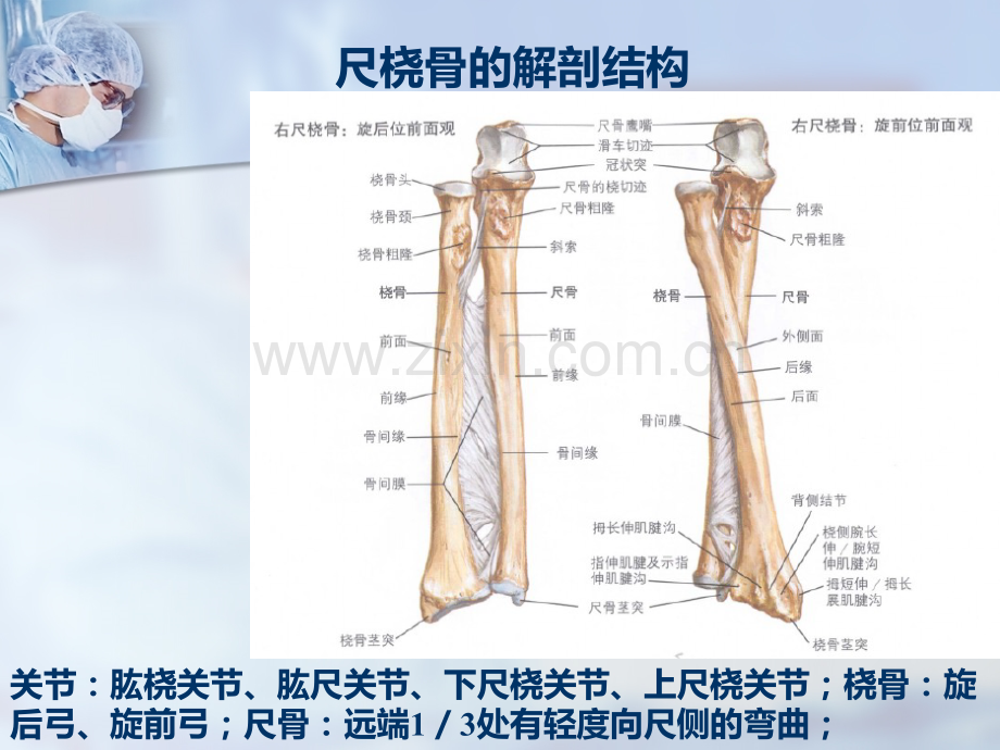 尺桡骨干双骨折.pptx_第1页