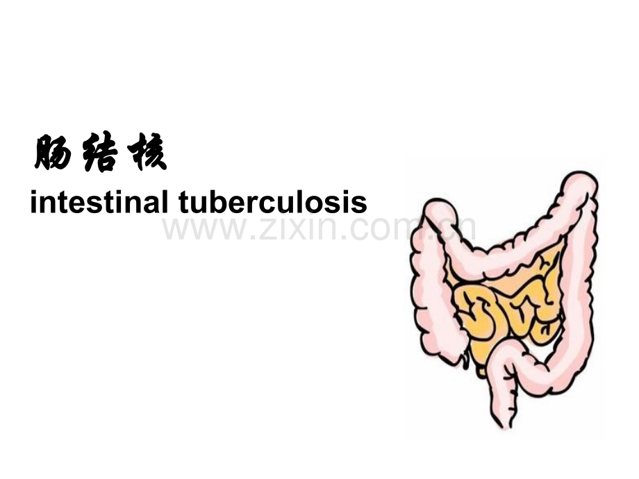 内科护理肠结核及结核性腹膜炎.pptx_第2页