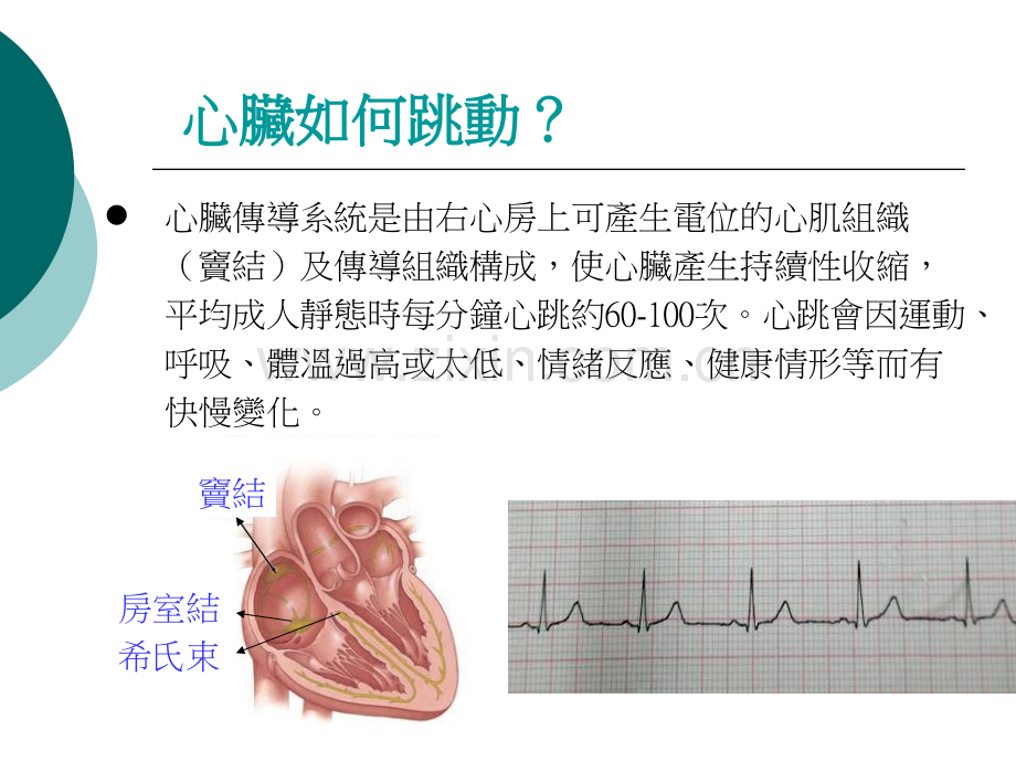 医药健康心脏内科心律调节器卫教文档.pptx_第3页