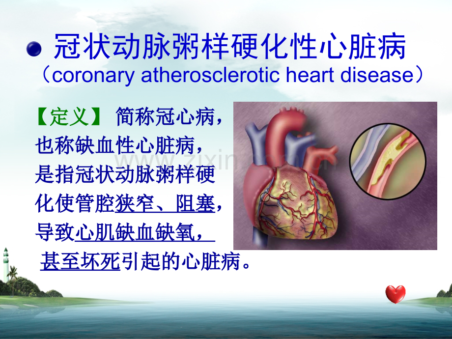 冠心病病人的护理上传1副本.pptx_第2页