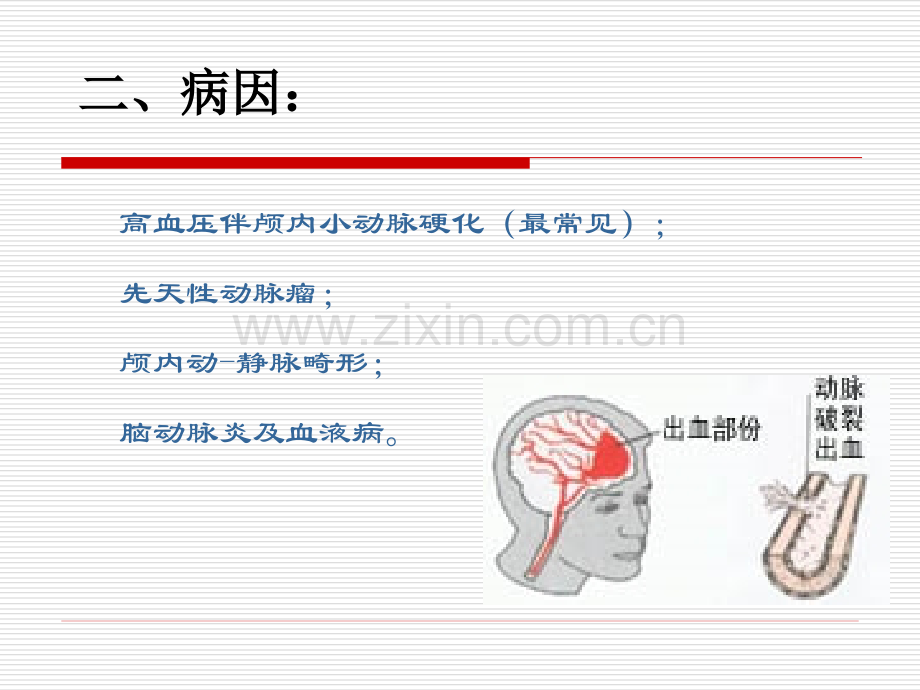 小讲课脑出血业务学习.pptx_第3页