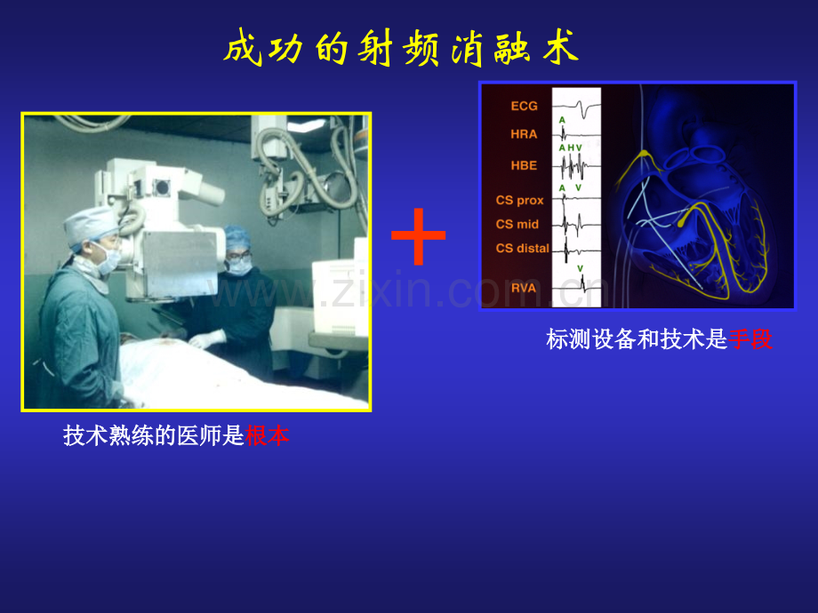 心脏电生理介入治.pptx_第3页