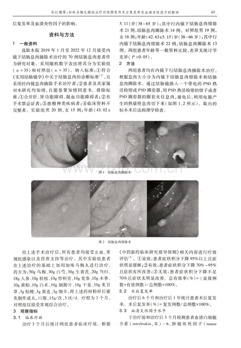 加味乌梅丸辅助治疗对结肠息肉术后复发率及血清炎性因子的影响.pdf_第2页