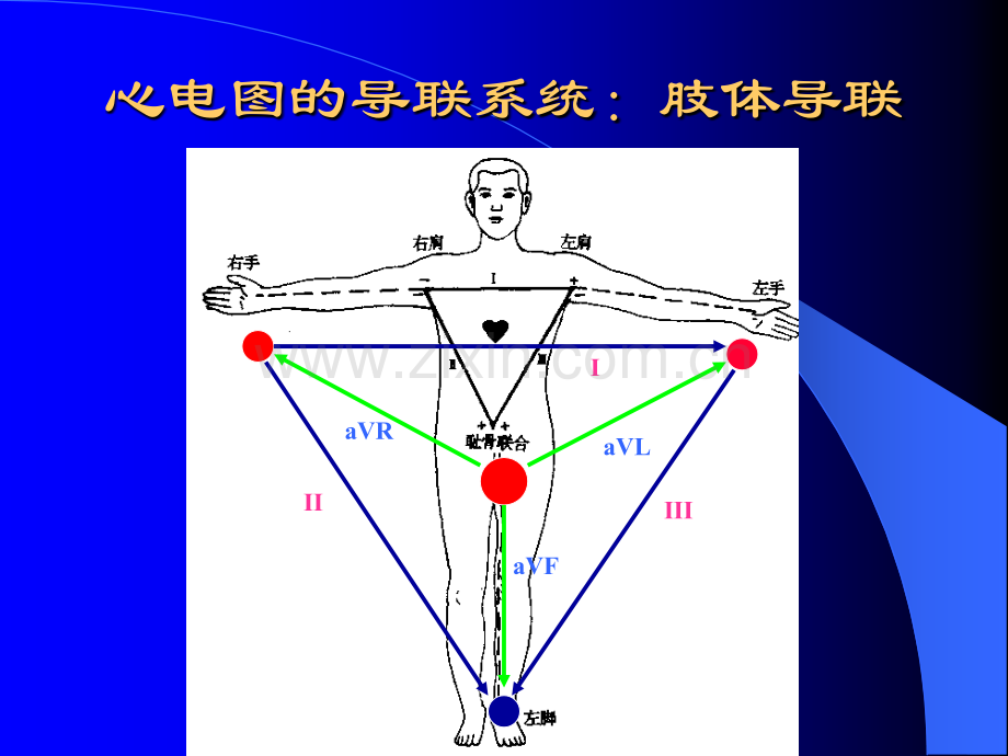 急诊科常见异常心电图.pptx_第3页