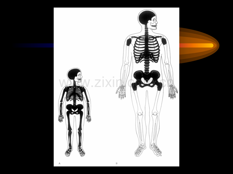 溶血性疾病zzq123.pptx_第3页